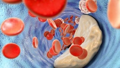 新陳代謝(xiè)是(shì)如(rú)何開(kāi)始的(de)？ 或與一(yī)種鐵(tiě)氧還(hái)原蛋白(bái)有(yǒu)關